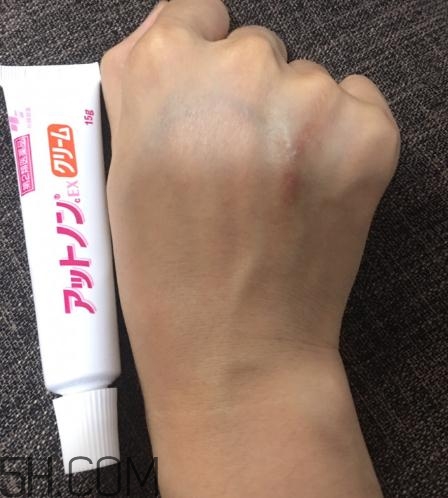 小林制藥祛疤膏有效嗎？小林制藥祛疤膏怎么樣？