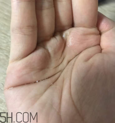 雪肌精卸妝油糊眼睛嗎？雪肌精卸妝油悶痘嗎？