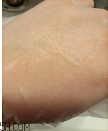 WIS痘肌修護(hù)面膜有效嗎？適合敏感肌嗎？