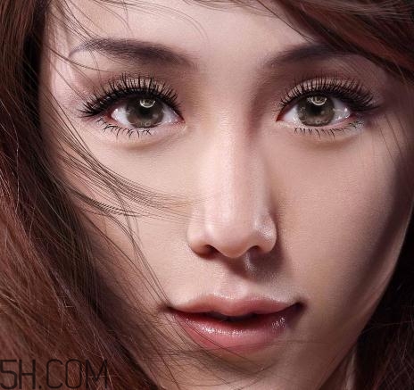 上瞼提肌手術(shù)有必要嗎？上瞼提肌后是永久的嗎？