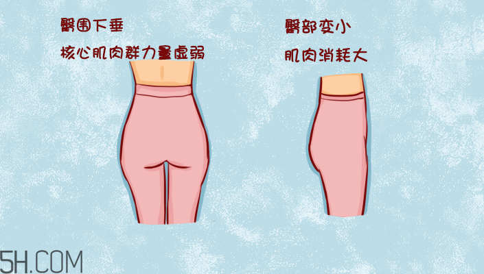 臀部護理對健康有什么影響？日常如何保養(yǎng)臀部健康？
