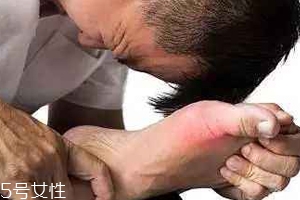痛風可以治愈嗎？無法治愈但能控制