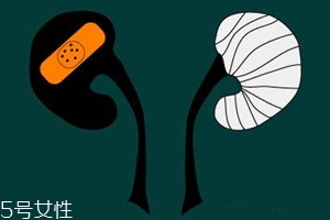 腎病為什么會發(fā)展到尿毒癥？這些因素一定要注意