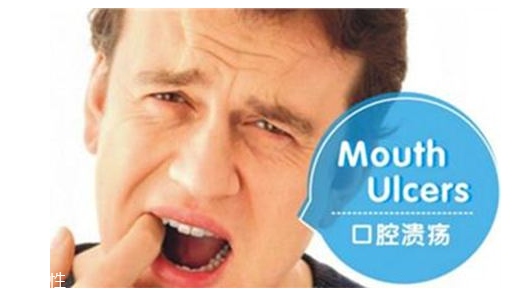 潰瘍的根源在哪里？也許僅僅只是牙膏沒選對(duì)