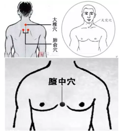 吮痧有什么療效？最溫柔的治病方法