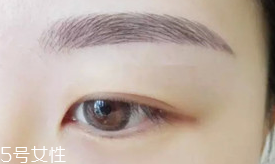 激光洗眉恢復(fù)期有疤痕怎么辦？激光洗眉毛之后正確護(hù)理方法