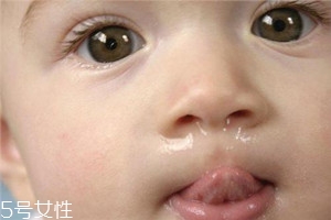 冬季寶寶流鼻涕是什么原因？教你幾招輕松應對