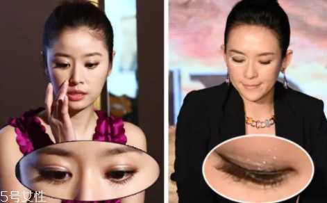 內雙怎么進化成雙眼皮？全是雙眼皮貼的功勞