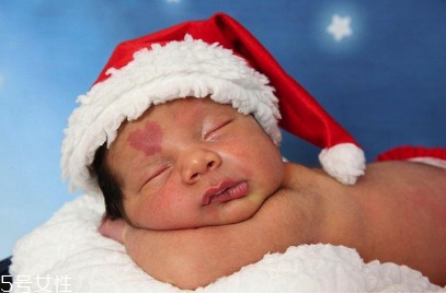 胎記長(zhǎng)在哪里有福氣？胎記的本質(zhì)是色素沉著