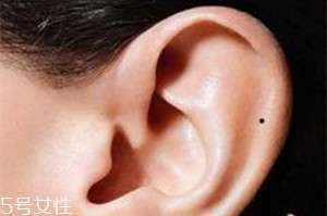 臉上哪些痣不能去掉？這些痣不能隨便祛掉