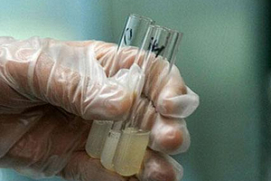 捐精有什么危害？專家稱沒(méi)有危害