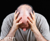 脫發(fā)有沒有治？只要不是禿子就有得治