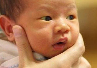 新生兒長黃疸怎么辦？有些黃疸癥狀媽媽們可別忽視