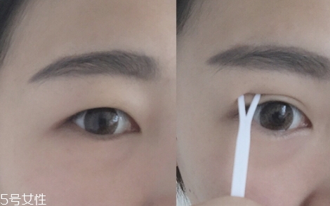 雙眼皮貼一般多少錢？