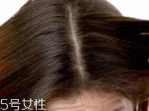 油性頭發(fā)跟什么有關(guān)？離不了這6個(gè)原因