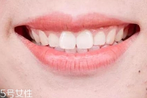 口紅病有哪些癥狀？使用不當(dāng)引發(fā)癌癥