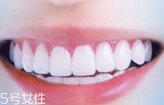 牙線和漱口水是否必要？抑菌護(hù)牙好習(xí)慣