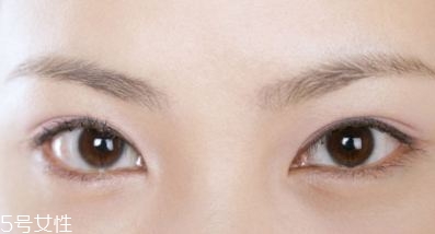 割雙眼皮的術(shù)前準(zhǔn)備有哪些？割雙眼皮的常見做法