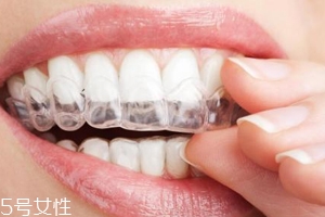 隱形牙套可以放餐巾紙上嗎？不衛(wèi)生