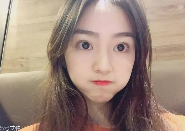 割雙眼皮要注意什么？割雙眼皮充血是正?，F(xiàn)象