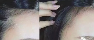 眉粉可以當(dāng)發(fā)際線粉嗎？解救高發(fā)際線的技巧