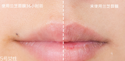 蘭芝唇膜吃進去怎么辦？擁有水嫩嘴唇
