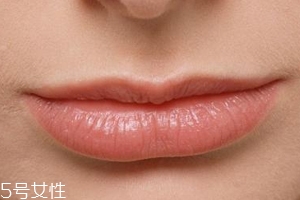 嘴唇干裂是一種病嗎？治療口角炎從改善習(xí)慣入手