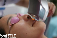 科技脫毛有哪些種類？冰點脫毛不毀毛囊