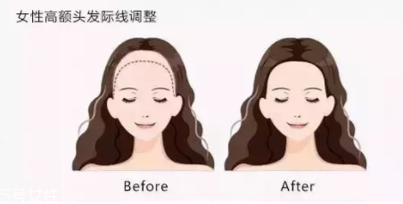 發(fā)際線粉填充和發(fā)際線筆哪個(gè)好？配合使用才最完美
