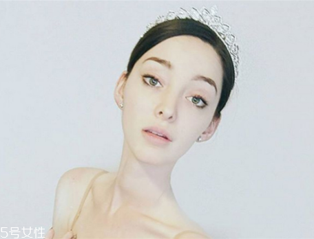 法令紋填充需要幾只玻尿酸？千萬(wàn)不可過(guò)量