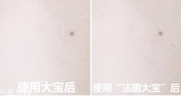 范爺同款法國(guó)大寶Embryolisse和大寶SOD蜜哪個(gè)好用？