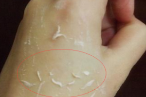 去角質凝露多久用一次？皮厚一周一次