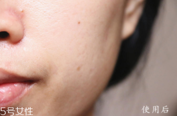 悅木之源和伊麗莎白雅頓哪個好？兩款精華大比拼