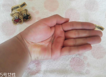 柳屋生發(fā)水有用嗎？一個月后長出新發(fā)