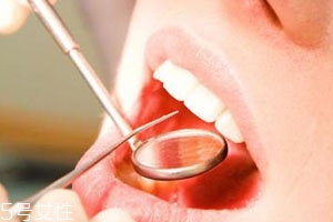 黃連能治口腔潰瘍嗎 黃連治療口腔潰瘍偏方 黃連能治口腔潰瘍嗎 黃連治療口腔潰瘍偏方