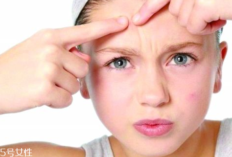 skinb5抗痘護(hù)膚片有效果嗎？