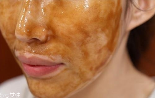 夏天油皮不能敷哪種面膜？這三種面膜越敷越油