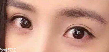 葉黃素能治療夜盲癥嗎？看什么類型的