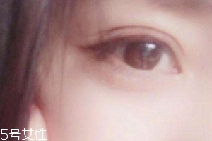 葉黃素一天吃多少毫克？按說明服用