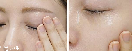 高絲卸妝油粉色瓶適合痘痘肌嗎 高絲卸妝油各個(gè)顏色區(qū)別 高絲卸妝油粉色瓶適合痘痘肌嗎 高絲卸妝油各個(gè)顏色區(qū)別