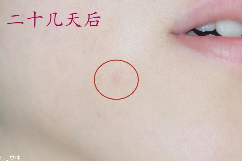 雅詩(shī)蘭黛晶透沁白防曬搖搖乳成膜快嗎？適合油痘皮嗎？
