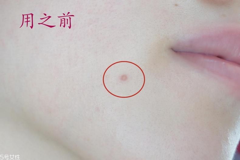 雅詩(shī)蘭黛晶透沁白防曬搖搖乳成膜快嗎？適合油痘皮嗎？