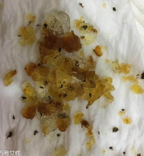 桃膠能和雞蛋一起吃嗎？桃膠配雞蛋可以嗎？