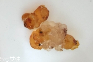桃膠可以用開水泡嗎？用開水泡桃膠好嗎？