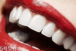 冷光美白會反彈嗎？冷光美白心得