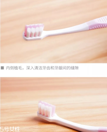 超聲波潔牙牙齒會變白嗎？超聲波潔牙心得
