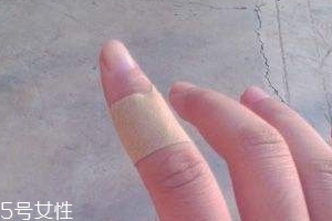 創(chuàng)可貼可以消腫嗎？創(chuàng)可貼有消腫功效嗎？