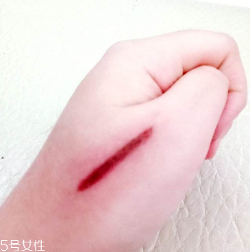 創(chuàng)可貼和肉連著怎么辦？創(chuàng)可貼連著肉怎么處理？