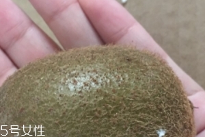綠心獼猴桃含葉酸嗎？綠心獼猴桃里面有葉酸嗎？