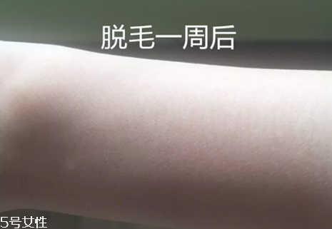 silkn脫毛儀永久脫嗎 silkn脫毛儀使用頻率 silkn脫毛儀永久脫嗎 silkn脫毛儀使用頻率